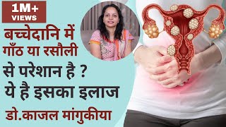 बच्चेदानि में गाँठ या रसौली के कारण लक्षण इलाज Fibroid Uterus Treatment Fibroid ka ilaj in hindi [upl. by Nairdad]