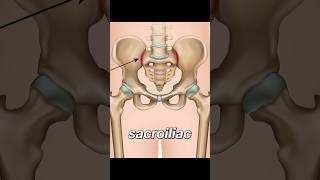 Sacroiliitis  lower back pain [upl. by Arde]