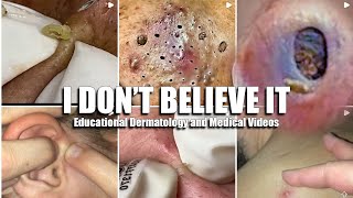 Acne Dermatology and Pimple Popping Website [upl. by Armelda]