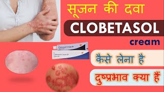 Clobetasol propionate cream IP  Tenovate cream  Precautions amp side effects in Hindi [upl. by Kcirdec]