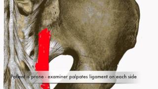 Provocation of Long Dorsal Sacroiliac Ligament Test CR [upl. by Chaudoin868]