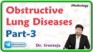 3 Obstructive Lung Diseases Part 3  USMLE Step 1 Pathology [upl. by Andri]