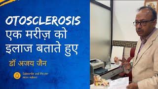 ओटोस्क्लेरोसिस के एक मरीज की काउंसलिंग करते हुए ईएनटी सर्जन।otosclerosis [upl. by Jock434]