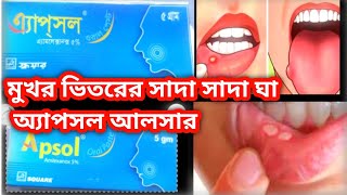 Apsol oral paste মুখের ভিতরে আপসল আলসারে ভুগছিলেন medicare watch 242 [upl. by Nanon]