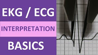 EKGECG Interpretation Basics Nursing NCLEX  QRS Complex P Wave T Wave PR Interval [upl. by Colyer]