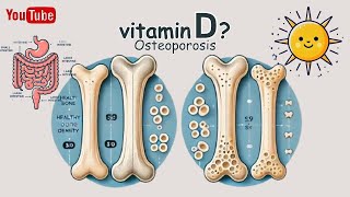 【Vitamin D】 Pharmacology Alfacalcidol Calcitriol amp Eldecalcitol Mechanism Simply Explained [upl. by Elberfeld424]