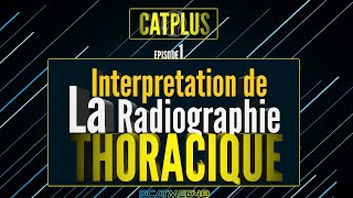 Catplus 1  Interprétation dune Radiographie Thoracique [upl. by Anoyet]