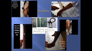 Deep Tendon reflex assessment Step by step procedure [upl. by Eliezer618]