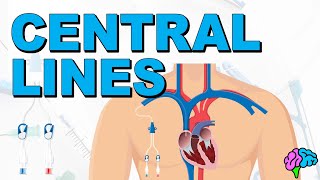 The Basics of Central Lines  Central Venous Catheters CVC [upl. by Rhoads]