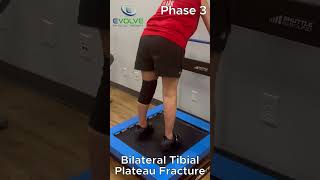 Bilateral Tibial Plateau Fractures Exercise Progression to Build Strength amp Stability With Jumping [upl. by Val]