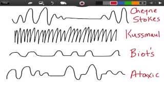 Irregular Breathing Patterns  EMTprepcom [upl. by Coster]