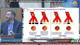 Communication du Pr ZAOUI EPH de Draa Ben Khedda Syndrome coronarien aigue [upl. by Marsh]