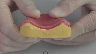 Denture Relining Rebase [upl. by Brocklin]