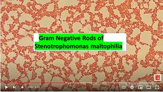 Gram Negative Rods of Stenotrophomonas maltophilia at various magnifications 1000X 2000X4000X [upl. by Melinde]