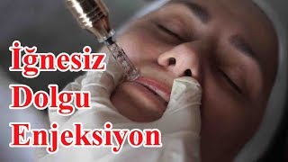 İğnesiz Enjeksiyon Dudak Dolgusu Nasıl Uygulanır [upl. by Shae]