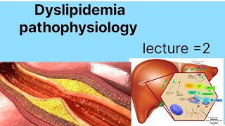 Pathophysiology of hyper dyslipidemia  dyslipidemia types and causes  hypercholesteolemia [upl. by Atikaj603]