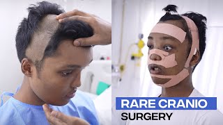 Incredible Craniofacial Transformation Witnessing a Rare Surgical Case [upl. by Melissa]