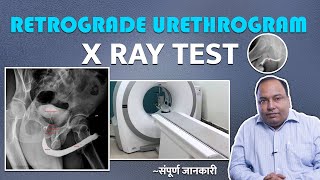 What is Retrograde Urethrogram Test   क्यों किया जाता है और क्या है इसकी प्रक्रिया [upl. by Dagney27]