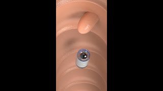 Capsule Endoscopy science shorts medicine [upl. by Elcin]