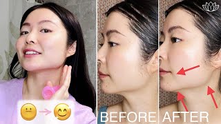 Cupping Massage For Double Chin Jawline Marionette Lines Effective amp NO Surgery  BEFORE amp AFTER [upl. by Ardnua]