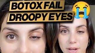 Botox Gone Wrong Droopy Eye  Cheap Fix [upl. by Jocelyn]