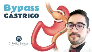 Cirurgia Bariátrica Bypass o que é isso Como é feita Precisa de vitamina a vida toda [upl. by Milson]