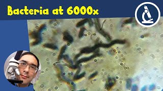 🔬 How to upgrade your microscope to get a 6000x magnification  Amateur Microscopy [upl. by Dnamra747]