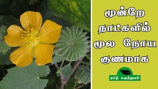 மூன்றே நாட்களில் மூல நோய் குணமாக  Thuthi ilai uses in Tamil  Abutilon Indicum for Piles [upl. by Nabois]