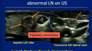 Thyroid Ultrasound Course [upl. by Massab812]