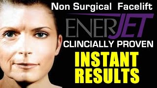 ENERJET Instant Facelift  Non Surgical Face Lift At BEAUTONICS Kent [upl. by Ydospahr]