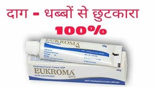 How To Remove Melasma  Hyperpigmentation  Eukroma cream uses sideeffects price review in hind [upl. by Ignatia]