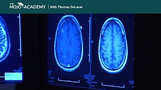 Your Brain on Ketones [upl. by Elyagiba113]