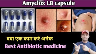 Amyclox LB capsule use dose benefits and side effects full review in hindi [upl. by Yecats]