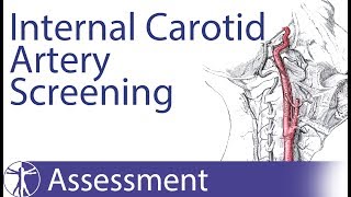 Carotid Artery Insufficiency  PreManipulative Screening [upl. by Kane]