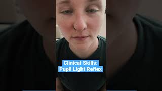 Pupil Light Reflex Clinical Skills  LevelUpRN [upl. by Sitof175]