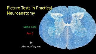 Picture Test in Neuroanatomy Spinal Cord 2 [upl. by Filippo]