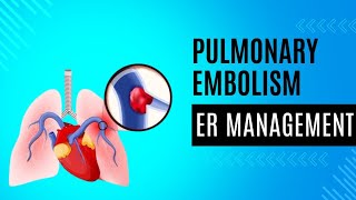 Pulmonary Embolism [upl. by Ailecnarf]