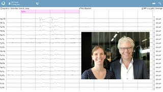 Artificial intelligence for EEG [upl. by Kynan]