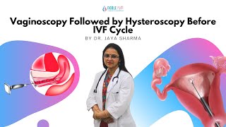 Vaginoscopy Followed by Hysteroscopy Before IVF Cycle IVF  DrJaya Sharma  Infertility [upl. by Merkley594]