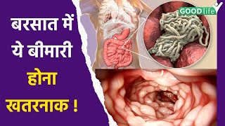 Amoebiasis Disease क्या है  Symptoms Reason और कैसे लें Precautions  Amoebasis Kya Hai Good Life [upl. by Sutherland]