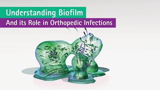 Understanding Biofilms in Orthopedic Infections Part 1 [upl. by Weber]