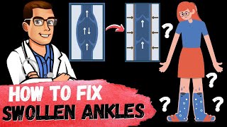 How to Get Rid of Swollen Ankles amp Swollen Legs FAST Causes amp Fixes [upl. by Ilaire]