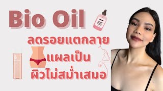 รีวิว Bio Oil ประสบการณ์ใช้จริง 11เดือน ลดรอยแตก แผลเป็น รอยคล้ำ [upl. by Strepphon]