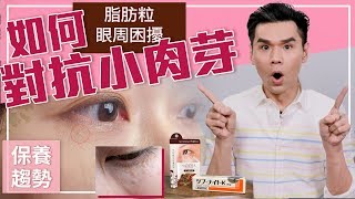 眼周保養困擾：如何對抗小肉芽？ ll Kevin想得美 ll Skincare Problem  How to Treat amp Prevent Milia [upl. by Myra]