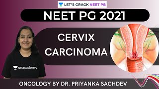 Lymphoma  Comprehensive Pathology  NEET PG  DrPriyanka Sachdev [upl. by Reinert]