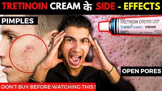 How to Apply Tretinoin Cream I Tretinoin Journey I Tretinoin Side Effects [upl. by Kosiur958]