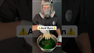 दुनिया का सबसे ताकतवर तेजाब  Worlds Strongest Acid By MAX Gyan [upl. by Nancie898]