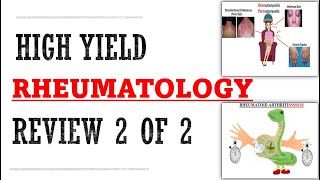 Rheumatology Part 2 of 2 Review  Mnemonics And Proven Ways To Memorize For Your Exams [upl. by Naitirb]