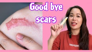 Scar remover Update Contractubex gel [upl. by Euqinitram]