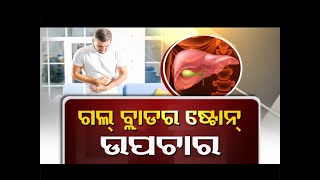 Doctor Doctor  Gallbladder Stones  Symptoms Causes and Treatment [upl. by Eustashe]